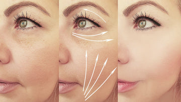 Non-Invasive Wrinkle Treatments: What Works, What It Costs and What You Can Do at Home