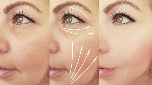 Non-Invasive Wrinkle Treatments: What Works, What It Costs and What You Can Do at Home
